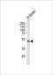 Potassium Voltage-Gated Channel Subfamily J Member 12 antibody, PA5-48887, Invitrogen Antibodies, Western Blot image 