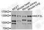 Guanine nucleotide exchange factor DBS antibody, A9966, ABclonal Technology, Western Blot image 