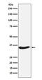 Exosome Component 7 antibody, M11141-2, Boster Biological Technology, Western Blot image 