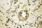 FAS antibody, 13098-1-AP, Proteintech Group, Immunohistochemistry paraffin image 
