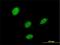 LIM Homeobox 5 antibody, H00064211-M04, Novus Biologicals, Immunocytochemistry image 