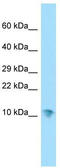 Small EDRK-Rich Factor 1B antibody, TA334375, Origene, Western Blot image 