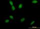 Mitogen-Activated Protein Kinase Kinase 4 antibody, H00006416-B01P, Novus Biologicals, Immunofluorescence image 