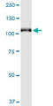 Glutamate Metabotropic Receptor 6 antibody, LS-C197361, Lifespan Biosciences, Western Blot image 