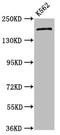 Proteasome Activator Subunit 4 antibody, CSB-PA618917LA01HU, Cusabio, Western Blot image 