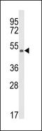 Kynurenine 3-Monooxygenase antibody, GTX81111, GeneTex, Western Blot image 