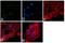 Eukaryotic Translation Initiation Factor 2 Subunit Alpha antibody, AHO0802, Invitrogen Antibodies, Immunofluorescence image 