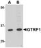 Growth Hormone Regulated TBC Protein 1 antibody, NBP1-76900, Novus Biologicals, Western Blot image 