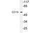 CD19 antibody, LS-C176652, Lifespan Biosciences, Western Blot image 