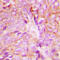 Protein Kinase C Delta antibody, GTX32346, GeneTex, Immunohistochemistry paraffin image 