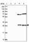 Nudix Hydrolase 8 antibody, PA5-59580, Invitrogen Antibodies, Western Blot image 