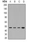 Phosphorylase Kinase Catalytic Subunit Gamma 2 antibody, abx141395, Abbexa, Western Blot image 