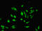 Histone Deacetylase 8 antibody, orb242886, Biorbyt, Immunocytochemistry image 