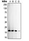 TIMP Metallopeptidase Inhibitor 2 antibody, MBS821723, MyBioSource, Western Blot image 