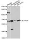 Activin A Receptor Type 2A antibody, STJ22506, St John
