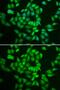 Casein Kinase 1 Epsilon antibody, GTX55549, GeneTex, Immunocytochemistry image 