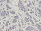 Proteasome 26S Subunit, ATPase 6 antibody, A09249-1, Boster Biological Technology, Immunohistochemistry paraffin image 