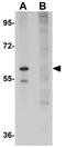 Schlafen Family Member 12 antibody, GTX31980, GeneTex, Western Blot image 