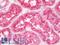 RIPK1 antibody, LS-B11088, Lifespan Biosciences, Immunohistochemistry paraffin image 