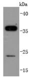 Sirtuin 5 antibody, NBP2-67885, Novus Biologicals, Western Blot image 