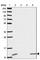 Diazepam Binding Inhibitor, Acyl-CoA Binding Protein antibody, HPA051428, Atlas Antibodies, Western Blot image 