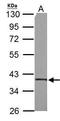 Succinate-CoA Ligase Alpha Subunit antibody, TA308974, Origene, Western Blot image 