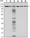 Cadherin 1 antibody, MA5-15717, Invitrogen Antibodies, Western Blot image 