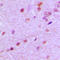 Neuronal Differentiation 2 antibody, GTX55161, GeneTex, Immunohistochemistry paraffin image 