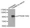 Protein Tyrosine Kinase 2 Beta antibody, TA333081, Origene, Western Blot image 