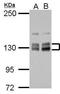Diphosphoinositol Pentakisphosphate Kinase 2 antibody, GTX111614, GeneTex, Western Blot image 