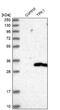 Thiamin pyrophosphokinase 1 antibody, NBP1-83152, Novus Biologicals, Western Blot image 