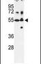 Cytochrome P450 Family 21 Subfamily A Member 2 antibody, PA5-15045, Invitrogen Antibodies, Western Blot image 