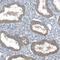 Solute Carrier Family 38 Member 2 antibody, NBP1-88872, Novus Biologicals, Immunohistochemistry paraffin image 