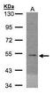 Eukaryotic Translation Initiation Factor 5 antibody, GTX106663, GeneTex, Western Blot image 