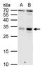 Kruppel Like Factor 9 antibody, GTX129316, GeneTex, Western Blot image 
