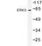 Mitogen-Activated Protein Kinase 6 antibody, LS-C177431, Lifespan Biosciences, Western Blot image 