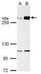 Tet Methylcytosine Dioxygenase 1 antibody, MA5-16312, Invitrogen Antibodies, Western Blot image 
