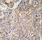 Chloride Intracellular Channel 1 antibody, LS-C100223, Lifespan Biosciences, Immunohistochemistry paraffin image 