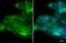 C-X-C Motif Chemokine Receptor 5 antibody, GTX100351, GeneTex, Immunofluorescence image 