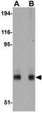 Interleukin 1 Receptor Associated Kinase 1 antibody, GTX17299, GeneTex, Western Blot image 