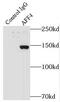 AF4/FMR2 Family Member 4 antibody, FNab00197, FineTest, Immunoprecipitation image 