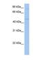 Transmembrane And Tetratricopeptide Repeat Containing 2 antibody, NBP1-69599, Novus Biologicals, Western Blot image 