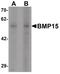 Bone morphogenetic protein 15 antibody, PA5-34401, Invitrogen Antibodies, Western Blot image 