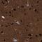 cAMP-regulated phosphoprotein 21 antibody, NBP1-90096, Novus Biologicals, Immunohistochemistry frozen image 