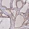 Ankyrin Repeat Domain 27 antibody, NBP1-85111, Novus Biologicals, Immunohistochemistry frozen image 