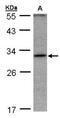Ankyrin Repeat Domain 45 antibody, NBP1-31620, Novus Biologicals, Western Blot image 