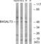 Beta-1,4-Galactosyltransferase 3 antibody, abx014263, Abbexa, Western Blot image 