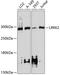 Leucine Rich Repeat Kinase 2 antibody, 13-870, ProSci, Western Blot image 