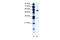 TACO antibody, 28-044, ProSci, Western Blot image 