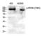 Eukaryotic Translation Initiation Factor 2 Alpha Kinase 3 antibody, PA5-40294, Invitrogen Antibodies, Western Blot image 